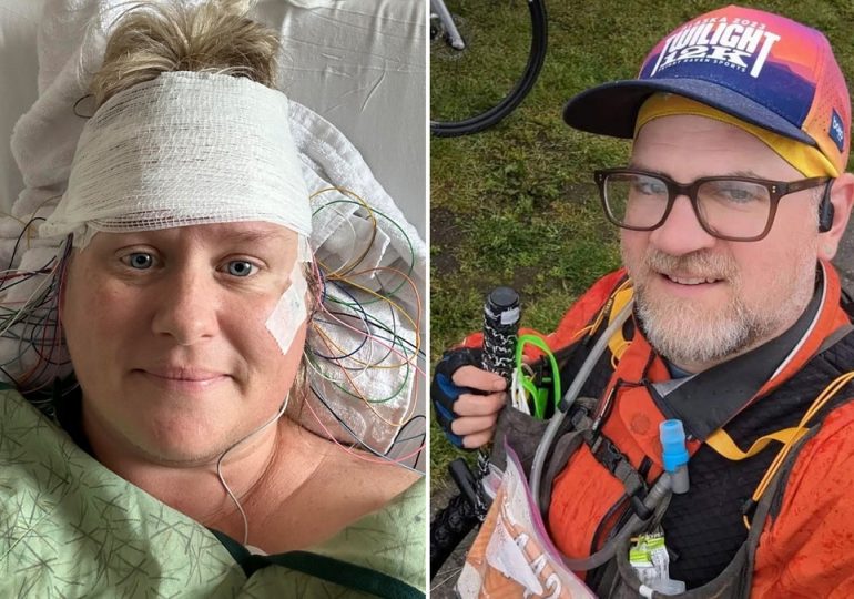 Stiff person syndrome patients share what it’s like to live with the rare disease