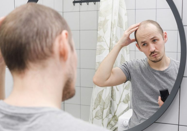 Cure for men's hair loss could be found in sugar stored in the body, study suggests