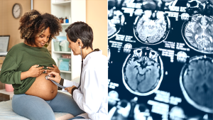 During pregnancy, a woman’s brain experiences ‘profound changes,’ new study finds