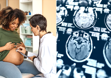 During pregnancy, a woman's brain experiences 'profound changes,' new study finds