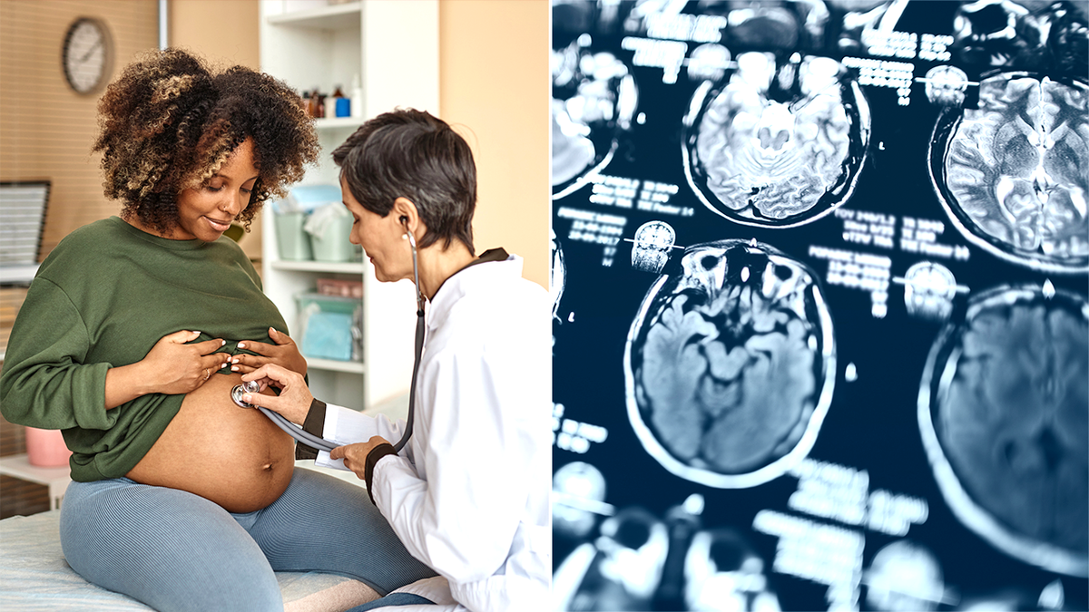 pregnant woman at the doctor next to a brain scan image