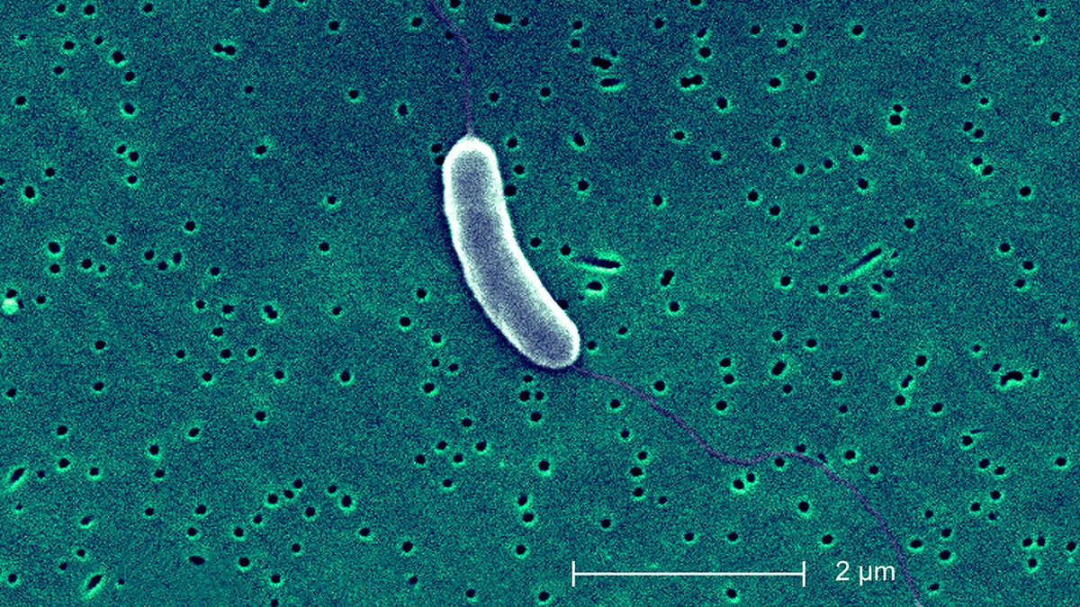 A microscope picture of the vibrio vulnificus bacterium