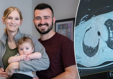 Pregnant woman and baby saved after doctors find grapefruit-sized tumor: 'Extremely rare'