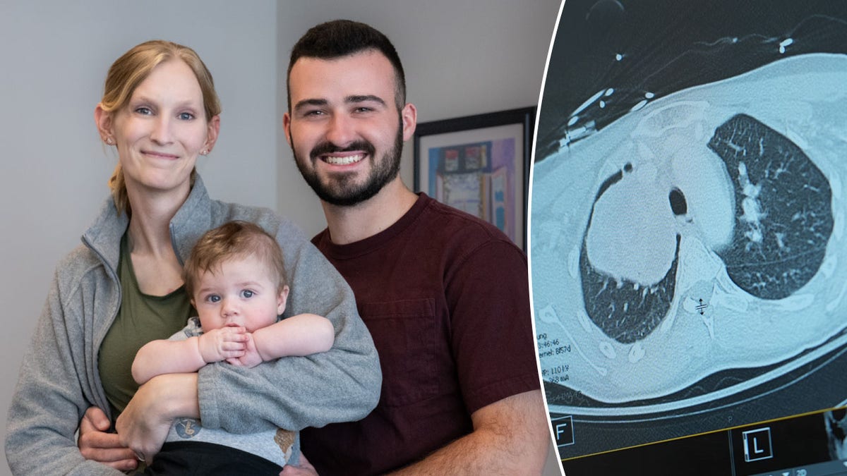 Pregnant woman and baby saved after doctors find grapefruit-sized tumor: ‘Extremely rare’