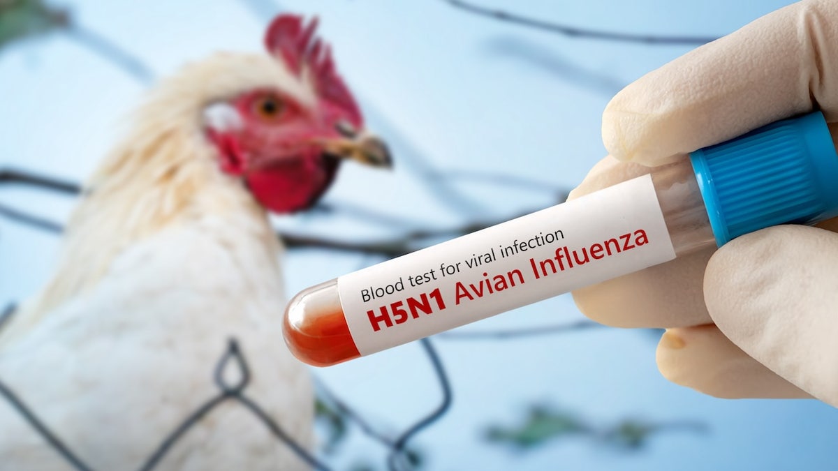 Louisiana reports first bird flu-related human death in US