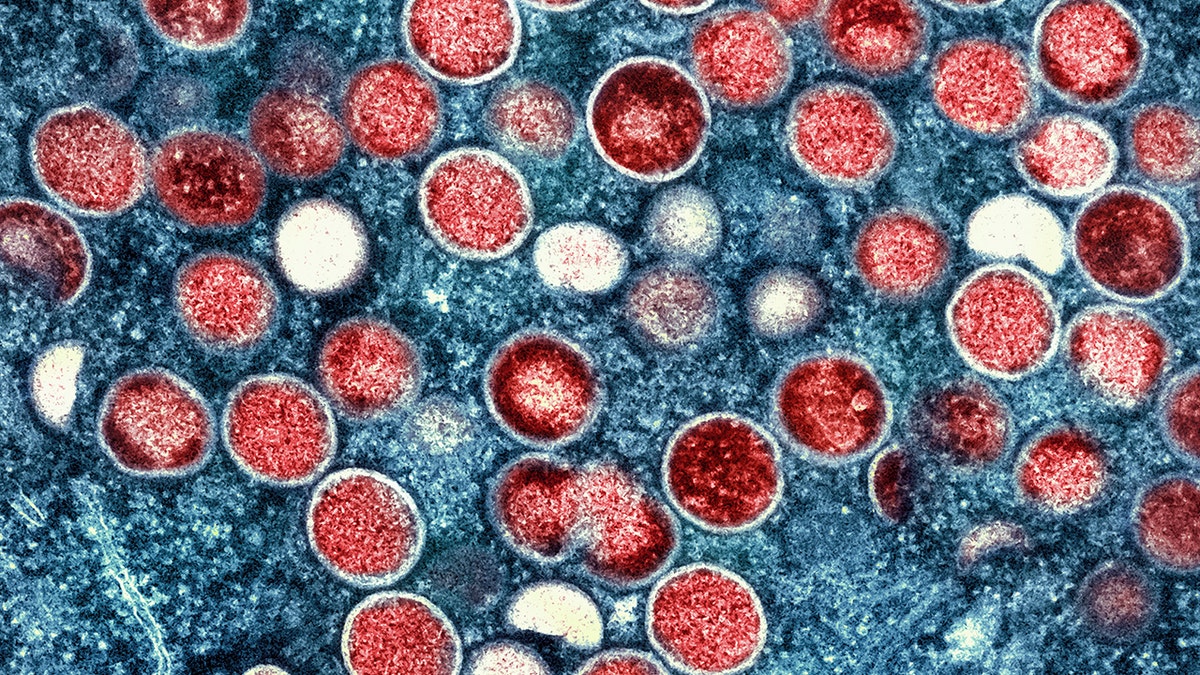 colorized transmission electron micrograph of monkeypox particles