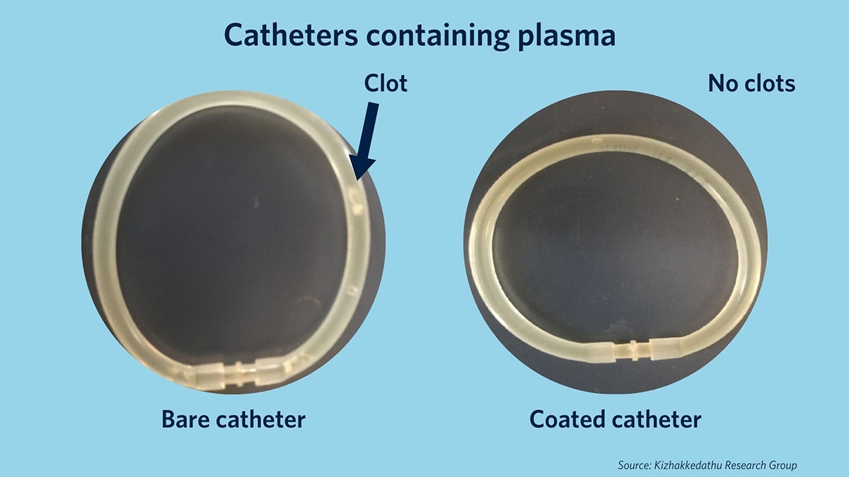 Researchers spot the difference between a bare catheter and coated one.